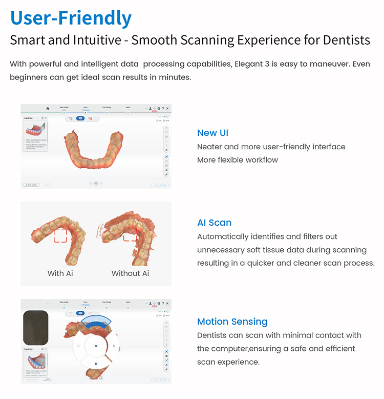 AXL013 Intraoral scanner